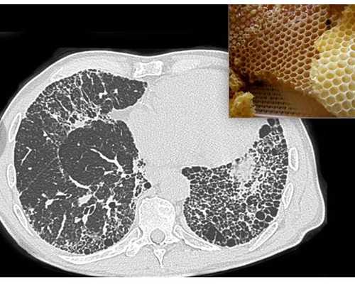胚胎停育的原因及症状，供精试管代怀