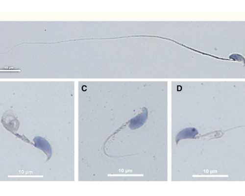 第三代泰国试管婴儿多少钱？泰国三代试管价钱，代怀包男宝